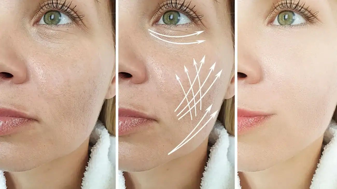 Can One Treatment Really Tackle More Than One Skin Concern Virginia Water?