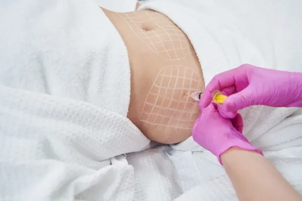 image of fat dissolving injections on love handles to help combat weight gain Virginia Water