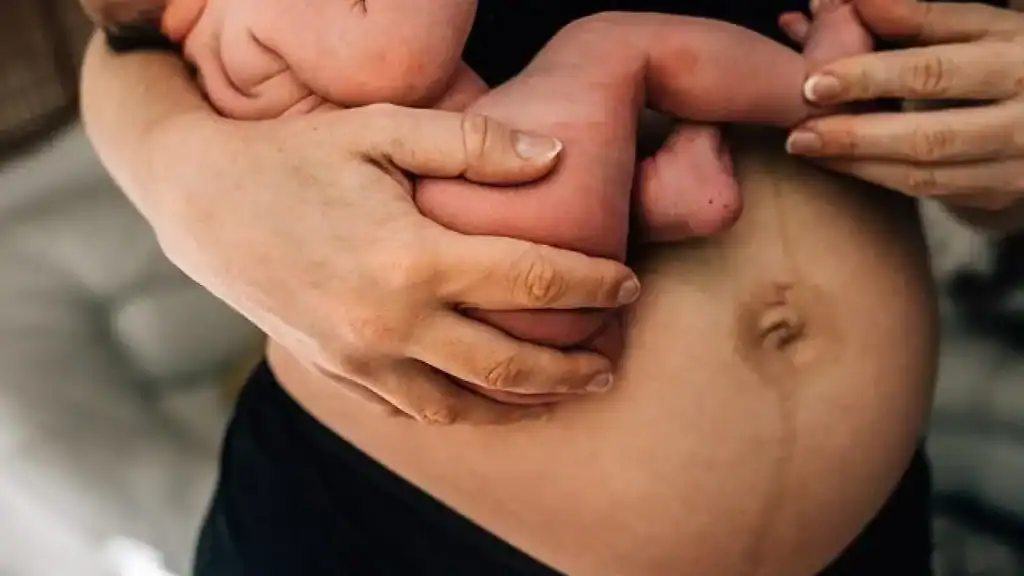 Why Is My Stomach Still Big After Pregnancy Virginia Water?